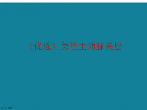 演示文稿急性主动脉夹层