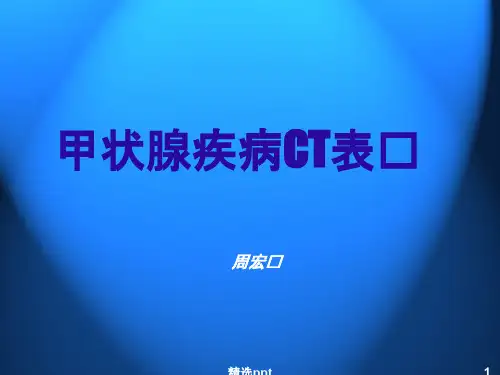 甲状腺疾病CT表现657450480