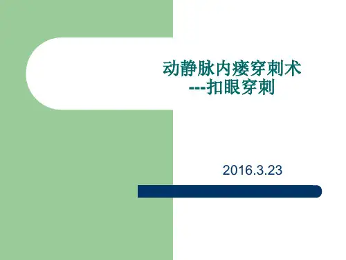 动静脉内瘘穿刺术---扣眼穿刺