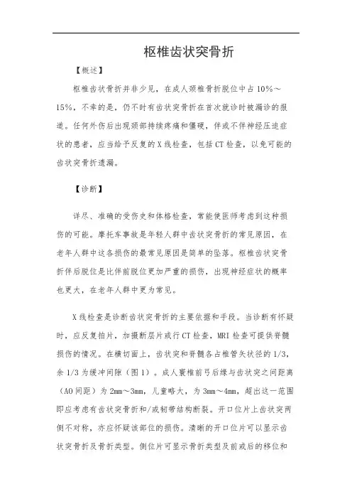 枢椎齿状突骨折