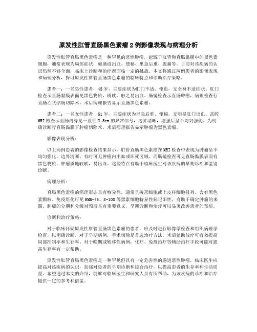 原发性肛管直肠黑色素瘤2例影像表现与病理分析