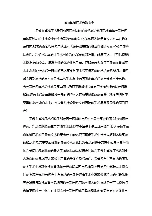 微血管减压术失败案例