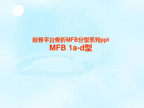 最新 胫骨平台骨折MFB分型系列课件