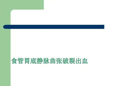 食管胃底静脉曲张