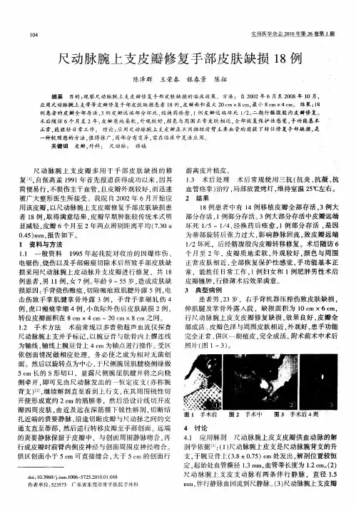 尺动脉腕上支皮瓣修复手部皮肤缺损18例