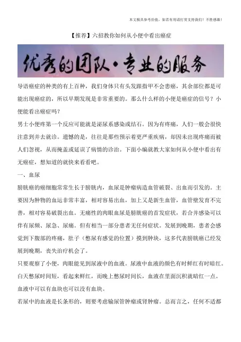 【推荐】六招教你如何从小便中看出癌症