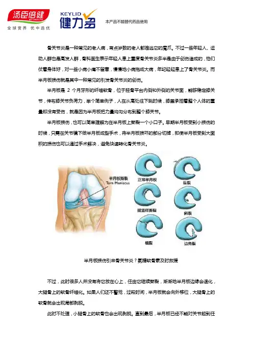 氨糖软骨素及时救援半月板损伤引来的骨关节炎