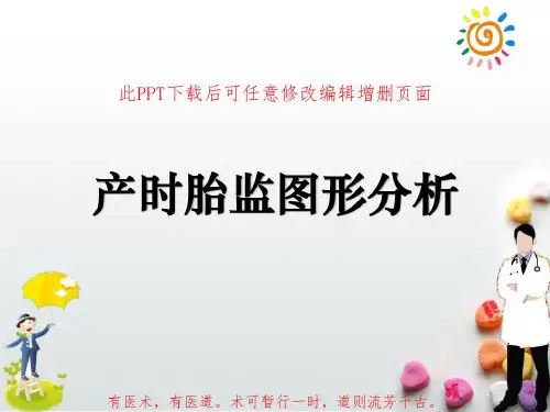 产时胎监图形分析成品_2022年学习资料