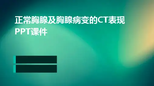 正常胸腺及胸腺病变的CT表现ppt课件