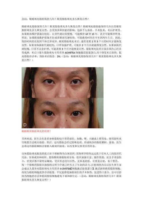 急问：眼睛填充脂肪保持几年？眼窝脂肪填充多久恢复自然？