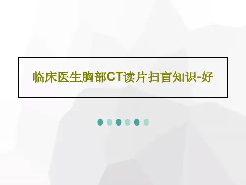 临床医生胸部CT读片扫盲知识-好PPT文档共92页