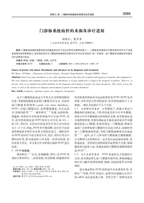 门静脉系统癌栓的来源及诊疗进展