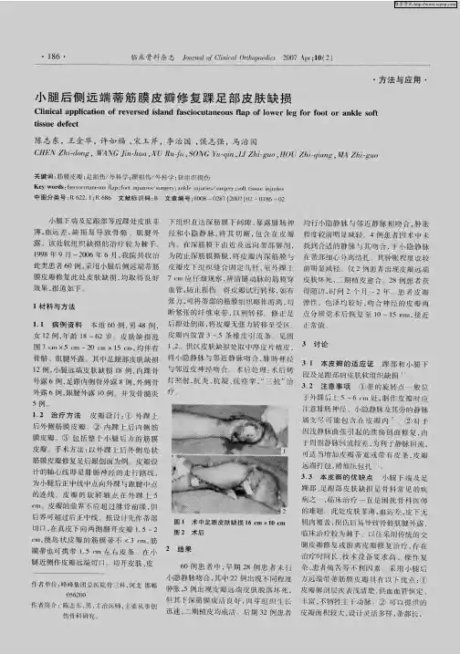 小腿后侧远端蒂筋膜皮瓣修复踝足部皮肤缺损