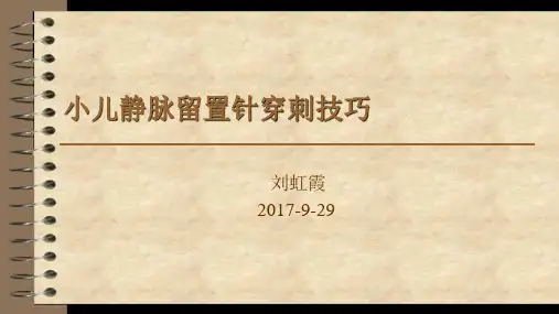 小儿静脉留置针穿刺技巧