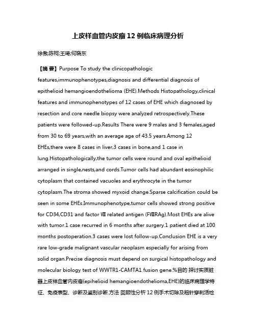 上皮样血管内皮瘤12例临床病理分析