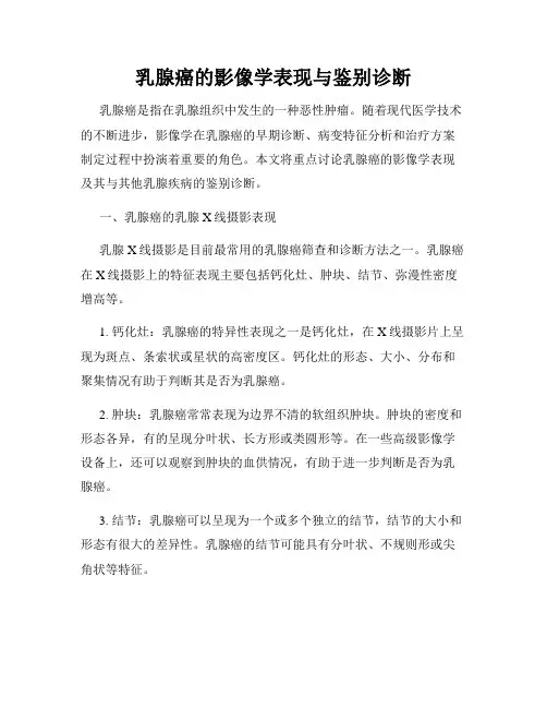 乳腺癌的影像学表现与鉴别诊断