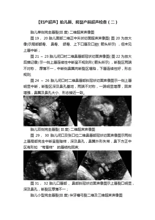 【妇产超声】胎儿唇、腭裂产前超声检查（二）