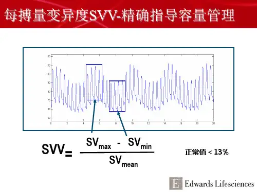 VigileoFloTrac工作原理及介绍