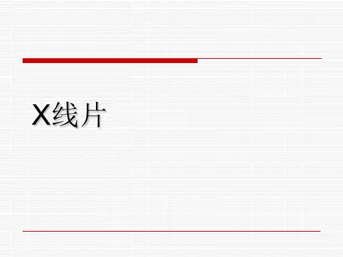 X线读片
