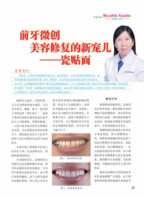 前牙微创美容修复的新宠儿——瓷贴面