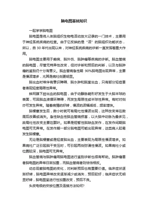 脑电图基础知识