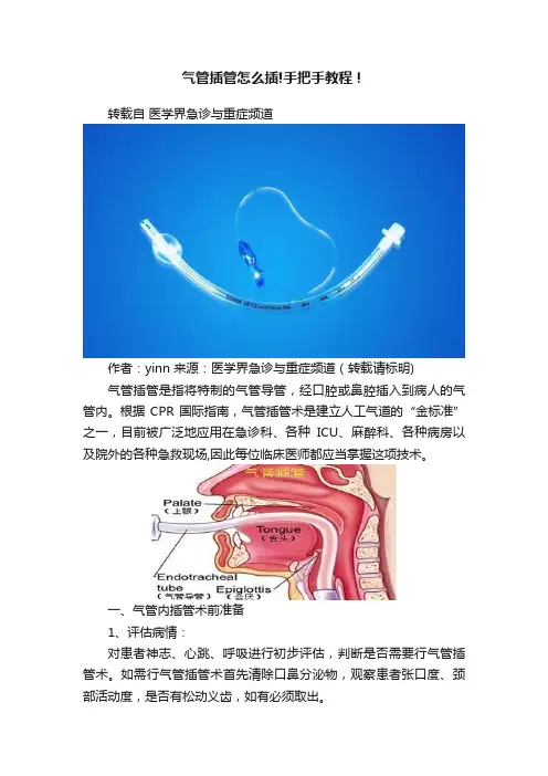 气管插管怎么插!手把手教程！