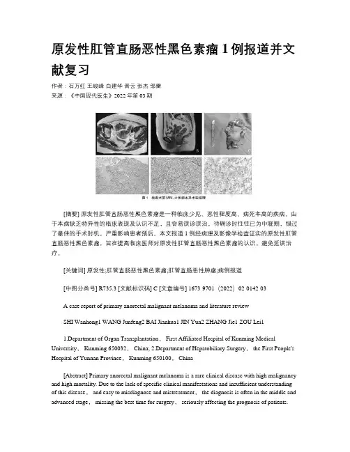 原发性肛管直肠恶性黑色素瘤1例报道并文献复习