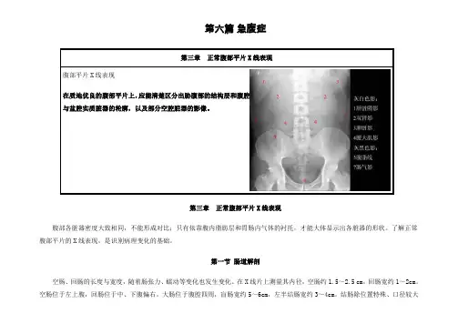 正常腹部平片X线表现