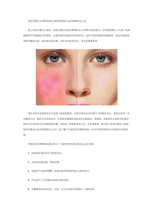 脸上角质层薄怎么修复,角质层薄有红血丝激素脸怎么办