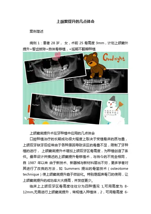 上颌窦提升的几点体会