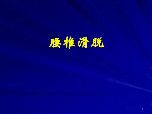 腰椎滑脱精品PPT课件