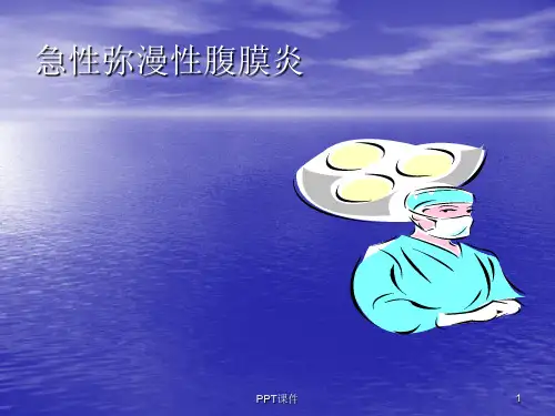 急性腹膜炎ppt课件