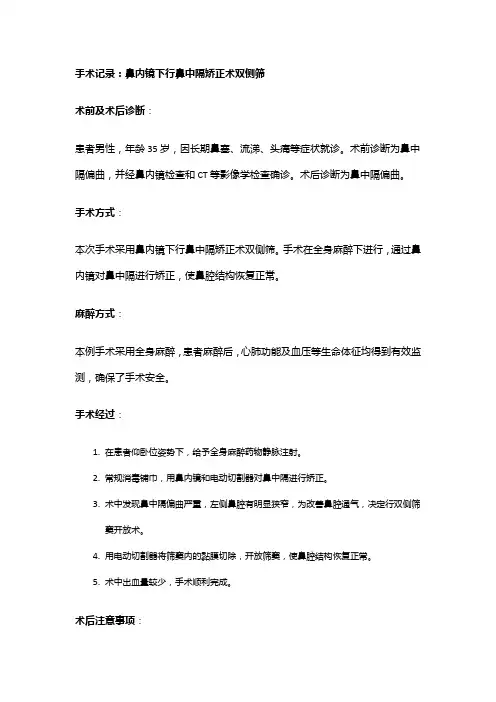 手术记录：鼻内镜下行鼻中隔矫正术双侧筛
