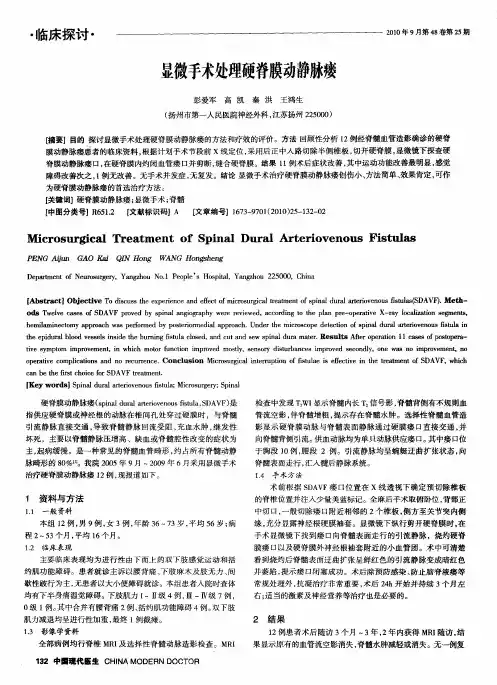 显微手术处理硬脊膜动静脉瘘
