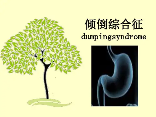 倾倒综合征汇总【19页】