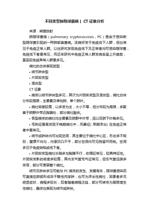 不同类型肺隐球菌病丨CT征象分析