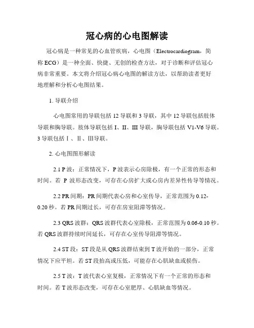 冠心病的心电图解读