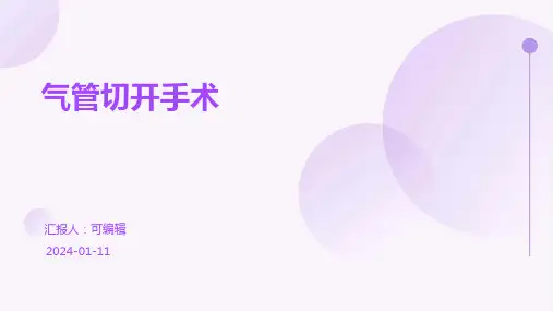 气管切开手术