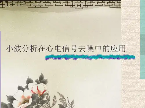 心电信号去噪小波分析