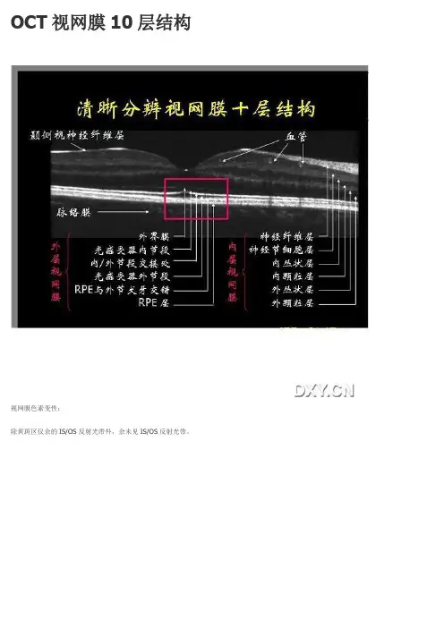 OCT视网膜10层结构讲解