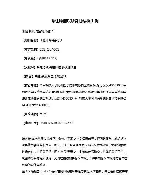脊柱肿瘤误诊脊柱结核1例