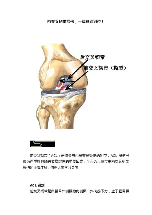 前交叉韧带损伤，一篇总结到位！