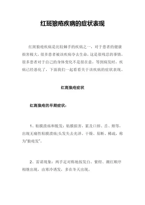 红斑狼疮疾病的症状表现