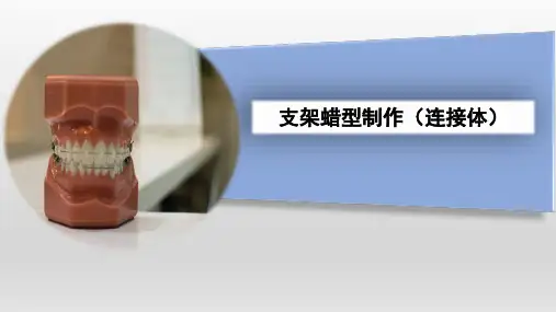 《口腔医学技术》课件——连接体的制作