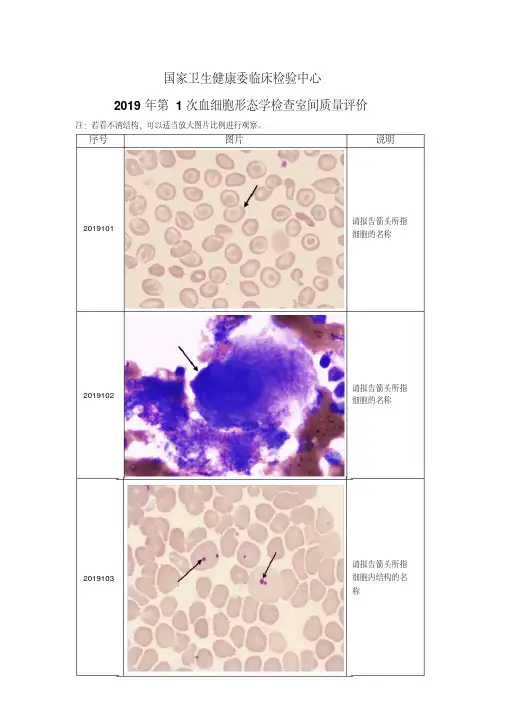 卫健委2019年血细胞形态学检查室间质量评价