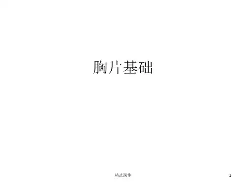 《胸片诊断基础》PPT课件