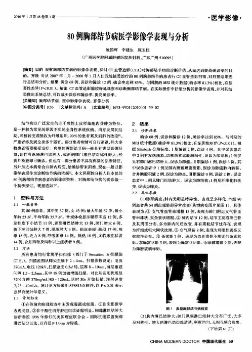 80例胸部结节病医学影像学表现与分析