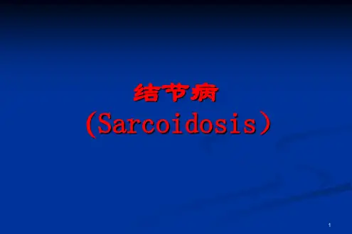 结节病讲稿ppt课件