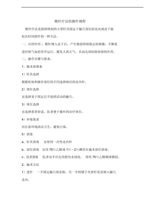 揿针操作规程1