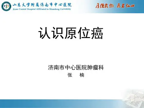 什么是原位癌--认识癌原位